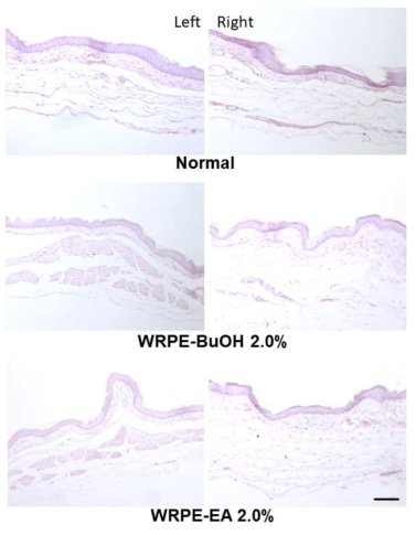 Histopathological findings of the cheek pouches applied with white rose petal extract (WRPE) in Syrian golden hamsters. WRPE-BuOH: butanol fraction of WRPE-MeOH extract, WRPE-EA: ethyl acetate fraction of WRPE-MeOH extract (scale bar = 100 μm)
