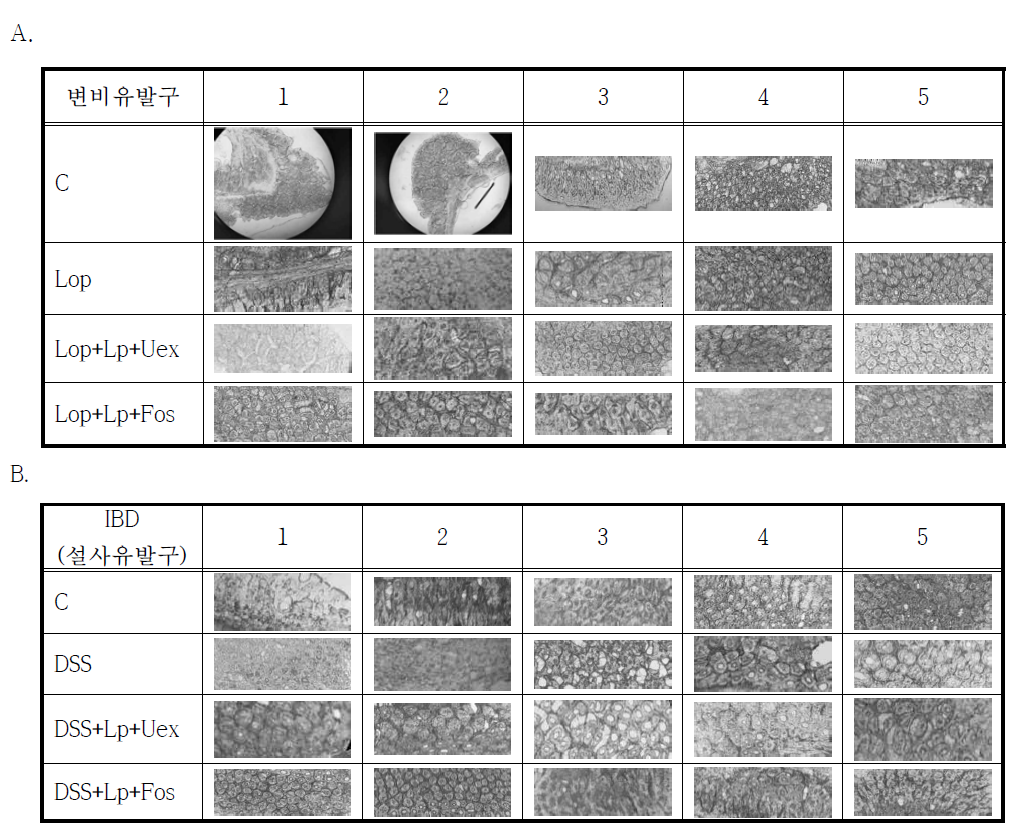 Microscopic examination of mucosal epithelium of descending colon. A. Constipation group. B. Inflammatory bowel disease group