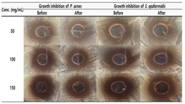 The antibacterial activity of mixed fermented before and after the extract on Propionibacterium acne, Staphylococcus epidermidis strain using ager well diffusion assay