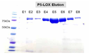 P5-Lipoxygenase 발현 단백질의 정제