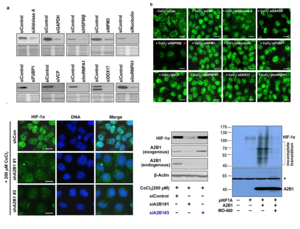Moracin O 유도체 MO-460과 결합하는 단백질억제와 HIF-1a 변화 확인