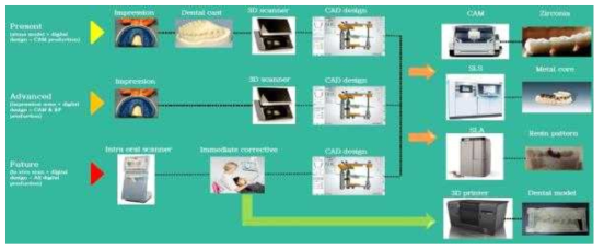 최근 치과보철물 제작에 Scanner, CAD/CAM 및 3D 프린팅 등 디지털 장비도입으로 인해 변화되고 있는 치과보철 제작 디지털화 도식