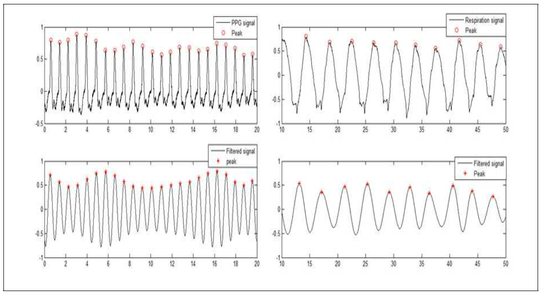 주파수 차감 방법을 이용해 측정한 신호(좌:심박 신호/우:호흡신호)와 기준 신호(좌:PPG/우:호흡벨트)의 피크 검출 결과