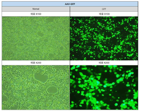 최대 생산성 조건에 따른 아데노부속바이러스의 GFP 발현