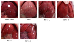 The liver size and shape