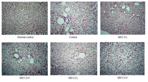 H-E staining in the liver section