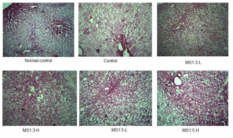 PAS staining in the liver section