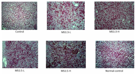 PAS staining in the liver section