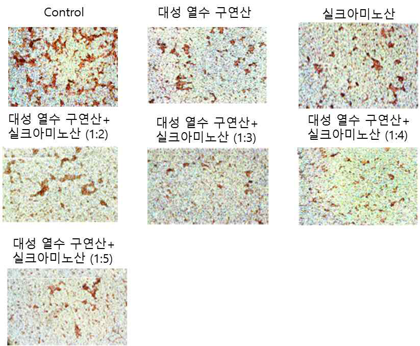 Oil-Red O staining of HepG2 cell with 1mM palmitate after the treatment of Daesung water extract mulberry extract plus citrate and silk protein