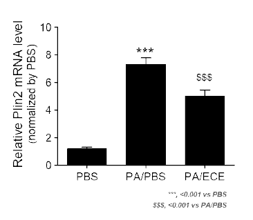 ECE 처리를 통한 대식세포 조절로 인한 Plin2 레벨