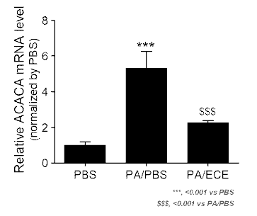 ECE 처리를 통한 대식세포 조절로 인한 ACACA 레벨