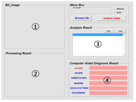 분석프로그램. ① 원본 초음파 이미지 ② 분석된 이미지 ③ 분석 결과 ④ 분석된 종양의 정보