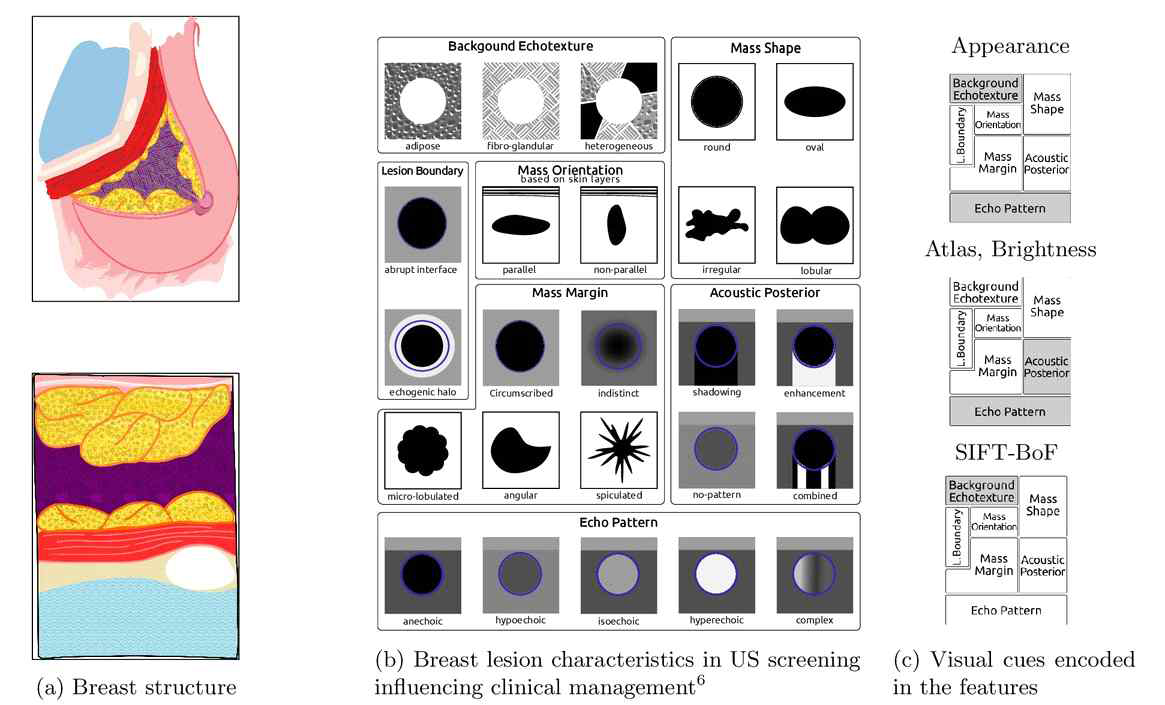 Breast lesion characteristics