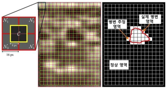 local texture는 5 개의 영역의 texture 정보