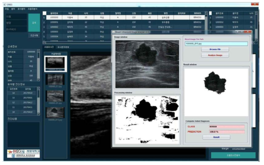 초음파 영상 분석 소프트웨어 연동