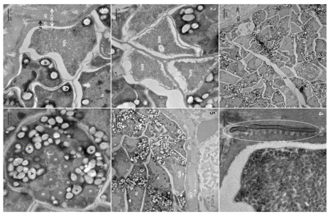 Transmission electron micrographs of cyst of S. cruzi from the heart of Bos taurus coreanae. 1. A high concentration of bradyzoites is enclosed by a thin walled cyst wall and septa. 2. The micronemes and septa. 3. The cyst wall. Cyst wall protrusions are adjacent to the sarcoplasm of host cell. 4. The magnified protrusion (circle). Microfilaments are not found in the protrusion. 5. The micronemes and nucleus. 6. The cross sectioned anterior region of bradyzoite containing several rhoptries. In addition to several rhoptries, amylopectin granules are presented in abundance. A, amylopectin granule; CW, cyst wall; GS, ground substance; MN, micronemes N, nucleus; P, protrusion; R, rhoptry S, septa; SP, sarcoplasm HC, host cell
