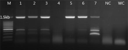 The PCR results reveals that positive samples (31/210) were amplified by the primer set of conserved region of 18S rRNA encoding gene of Sarcocystis species. PCR product (1.5 Kb) predicted from reference sequences of 18S rRNA encoding genes. Lane 1-7 = field samples. M = Marker. NC = negative sample, WC = water control (Negative controls)