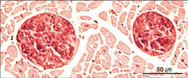 Photograph of sarcocystes from the H-E stained heart tissue of Korean native goat infected with S. tenella. The infection appears as round cyst embedded in the muscle fibers of the host cells