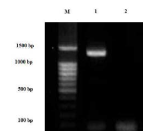 PCR products of Sarcocystis specimen. M; GLStm 100bp Ladder, lane 1=18S rRNA gene of Sarcocystis specimen, lane 2=negative control