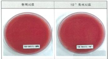 시제품(비티더블유) 내 바실러스 세레우스 검사시험