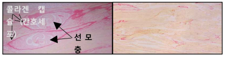 마우스 근육세포에 기생하는 기생충의 모습 (좌, x400), 근육섬유세포 내에 기생하면서 collagen합성을 유도하여 자신의 보호막 (nurse cell)을 형성하는 모습, 비감염 정상 마우스 근육 (우, x400). 빨간색으로 염색이 된 부분이 collagen 임