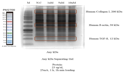 PCIF-2 약물을 1, 5, 10uM 농도로 처리한 이후, SDS-PAGE 상에서 단백질의 분포를 확인함 또한 human collagen I, beta-actin, TGF-beta가 반응하는 위치의 단백질의 크기를 확인함