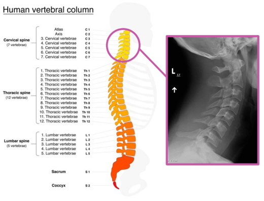 경추 구조 및 X선 사진