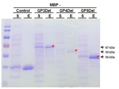 미생물에서 발현된 재조합 PRRSV 항원 단백질의 분리 및 정제