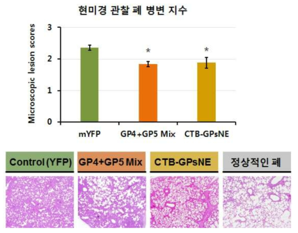 식물백신을 투여한 군(GP4+GP5 Mix, CTB-GPsNE)에서의 폐 병변 지수 감소 (현미경)
