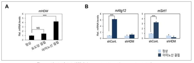 A) HDM의 RNA 발현 (NS: non significant/*** p value<0.001) B) HDM knock-down에 따른 오토파지 유전자 발현 변화
