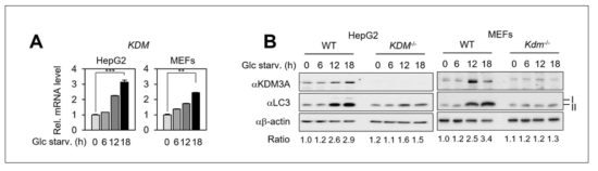당결핍 상황에서 KDM발현 증가 및 KDM 결손 세포주에서 오토파지 저해현상 관찰