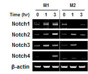 결핵균 H37Ra 감염 시 M1/M2 큰포식세포의 Notch family 유전자 활성 분석