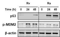 결핵균 H37Rv, H37Ra 감염 시 p53, MDM2 단백질 활성 비교