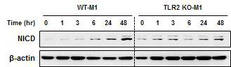 TLR2에 의존적인 M1 극성 큰포식세포의 NICD 활성