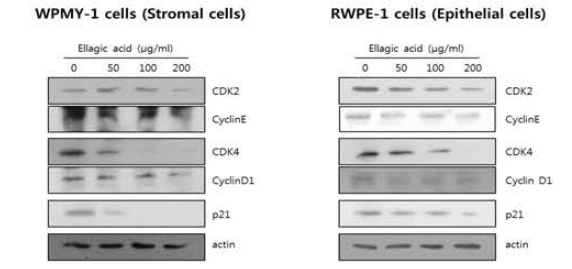 전립선세포 (간질세포, 상피세포)에서 엘라직산이 세포주기 단백질 발현에 미치는 영향