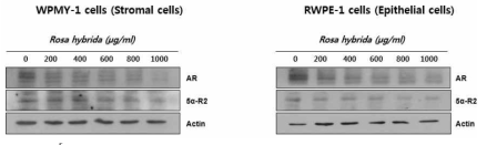 전립선세포 (간질세포, 상피세포)에서 장미 에탄올 추출물이 안드로젠 수용체 (AR) 및 5 알파 환원효소-2 (5α-R2) 의 발현에 미치는 영향