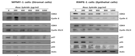 전립선세포 (간질세포, 상피세포)에서 장미 에탄올 추출물이 세포주기 단백질의 발현에 미치는 영향
