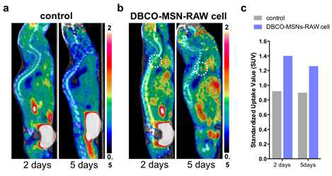 PET images of atherosclerosis by macrophage cell tracking via in vivo F-18 labeling. (a and b) Sagittal PET images of atherosclerosis in ApoE-/-mice on western diet for 30weeks, given only saline (control study; a) or DBCO-MSNs-RAW cells (cell tracking study; b) 2 or 5 days earlier, at 1 h intravenous post-injection of [18F]2, and (c) their standardized uptake values