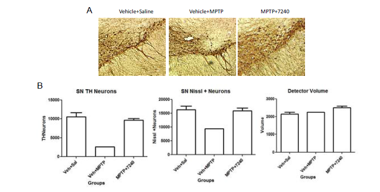 Ewha-7240에 의한 TH의 발현과 dopaminergic neuron의 감소억제