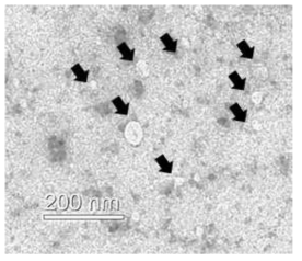 EF-TEM for Exosome