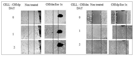 Recipient cell’s mobility is increased by Exosome