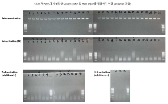 MBD-seq 수행을 위한 혈액 PBMC에서 분리한 genomic DNA (Before sonication)와 sonication한 fragmented DNA의 agarose gel 사진