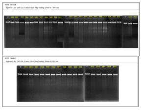 Agarose gel electrophoresis