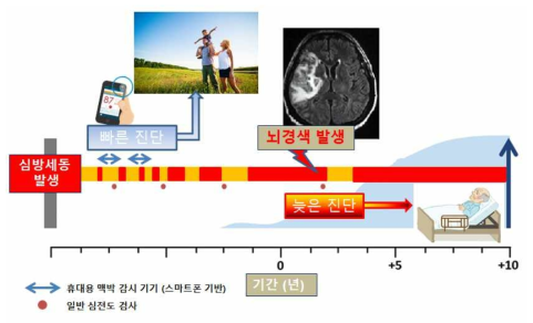 심방세동 조기 진단의 중요성