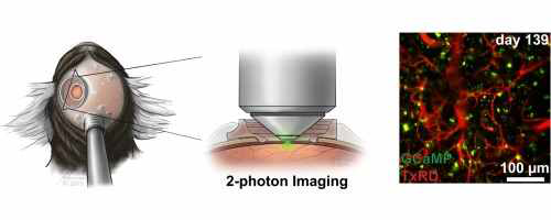 마우스 뇌의 two-photon imaging (Santisakultarm TP et al., J Neruosci Method, 2016)