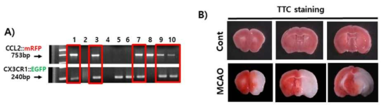 이중염증형광표지 마우스 유전형질 및 뇌 허혈 손상 분석