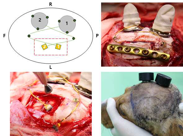 비글을 이용한 미세 전극 어레이 삽입 2차 수술의 계획도 및 비글 수술 사진