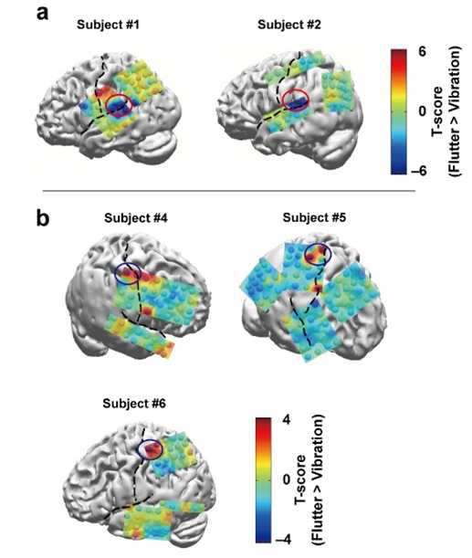 저주파와 고주파 감각 자극에 대한 뇌활성도의 차이를 나타내는 뇌지도