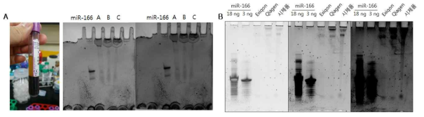 3명의 plasma에서 정제한 마이크로RNA (A), 정제 능력 비교 테스트 (B)