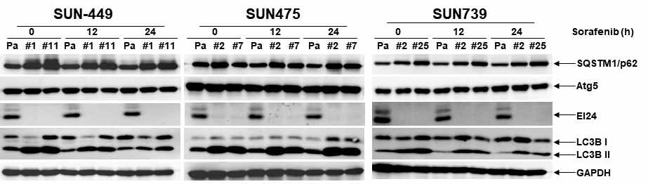 Western blot analysis of autophagy markers upon 10 μM sorafenib treatment